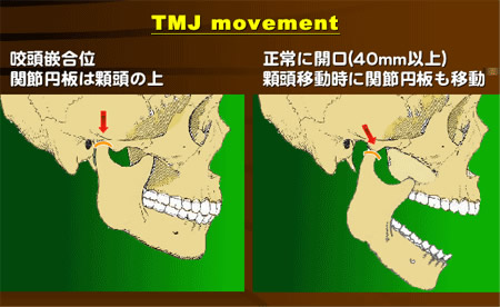 TMJ movement