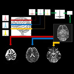 Multi-Band { Simultaneous Multislice (SMS) } EPI